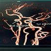 Kỷ Nguyên 3D MRI: 